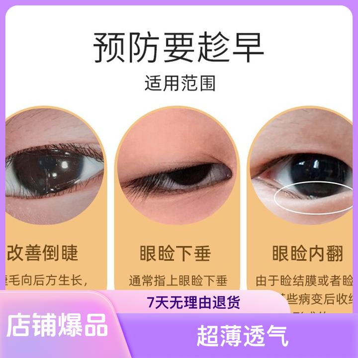 婴幼儿倒睫毛矫正贴宝宝低敏超薄上眼睑提拉倒睫毛贴神器化妆透气