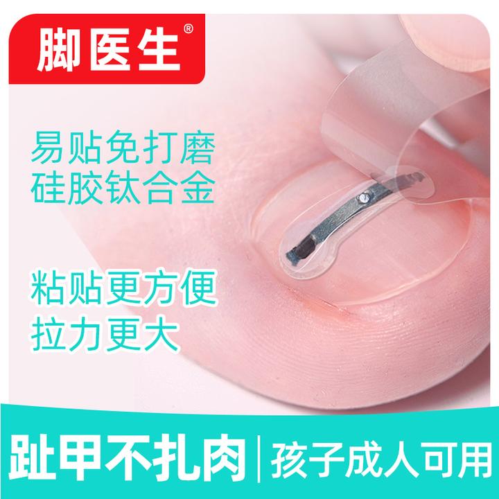 脚医生足部固定器指（趾）甲固定型钛合金硅胶贴片自适应指甲弧度款