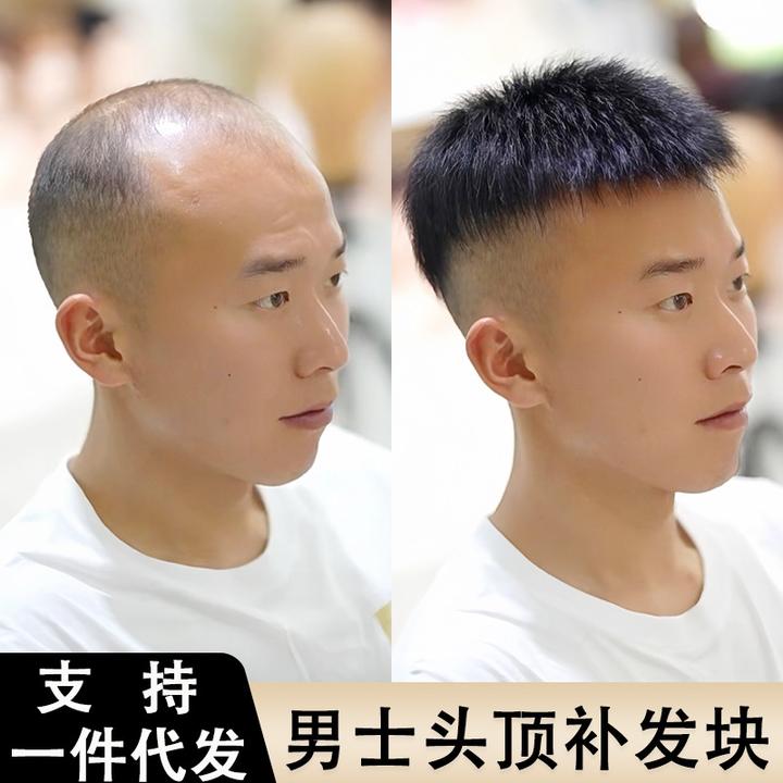 男士假发短发真发帅气隐形头顶补发块遮白发地中海秃头男士补发片
