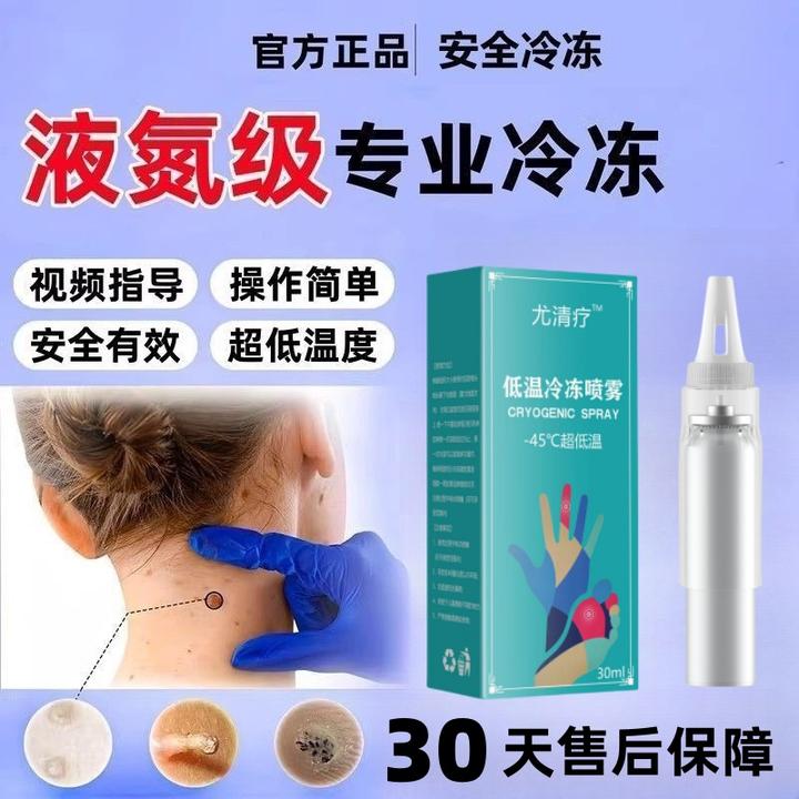 液氮低温祛尤喷雾零下196度液态冷冻除丝状寻常扁平跖尤尖锐神器