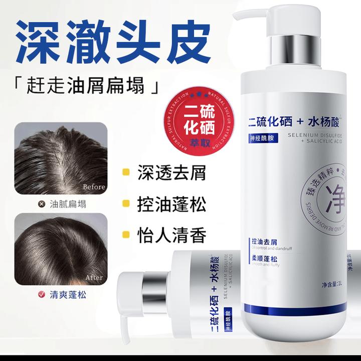 二硫化硒洗发水控油清爽蓬松去屑止痒水杨酸洗头膏露男女持久留香