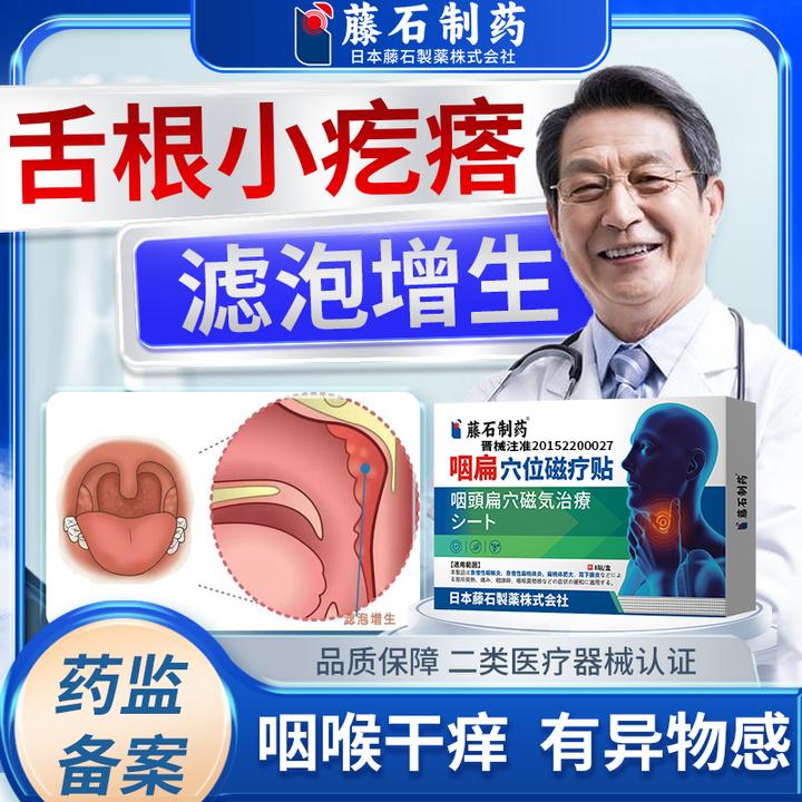 藤石制药咽扁穴位磁疗贴咽喉炎滤泡增生舌根有疙瘩嗓子干痒异物QU