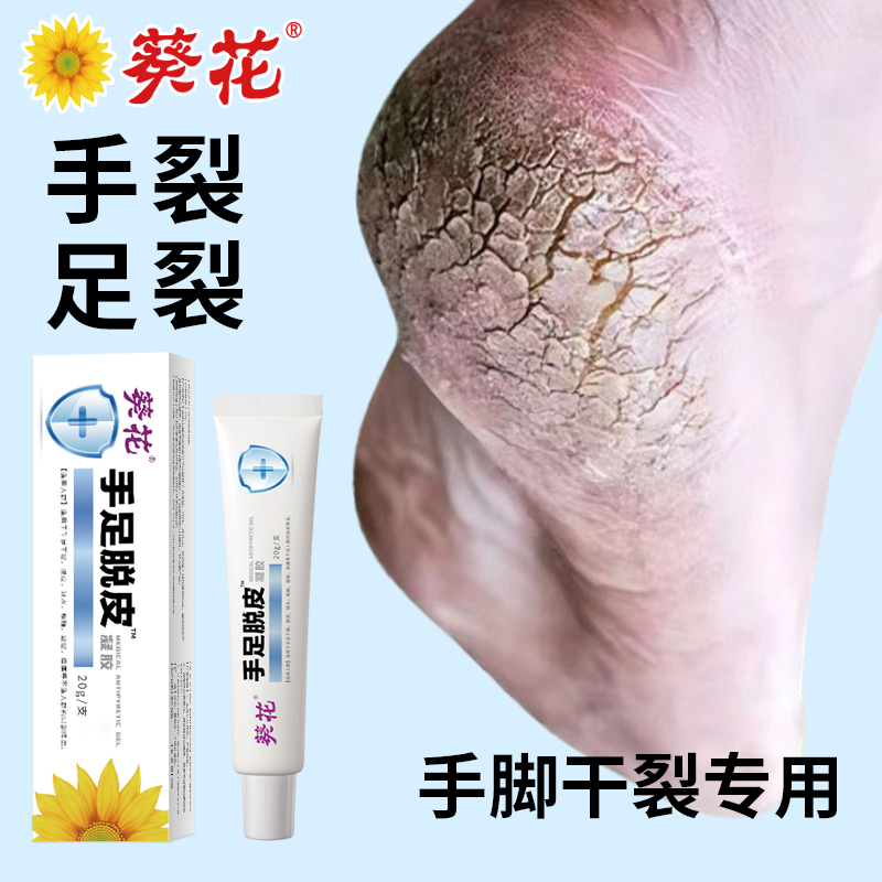 葵花【官方正品好用不贵】手足脱皮润肤护肤膏手足干燥皲裂粗糙起皮