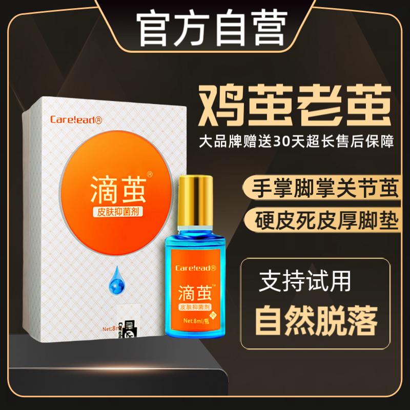 【滴茧正品】老茧去除软化剂刺除手脚鸡茧脚垫猴死皮硬皮草本修护膏
