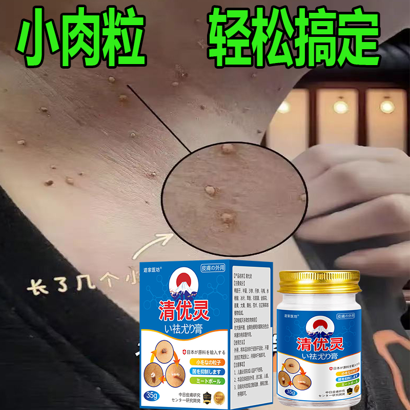 【日本配方】去猴子肉粒专用去优清克尤膏脖子手足腋下丝状扁平肉刺