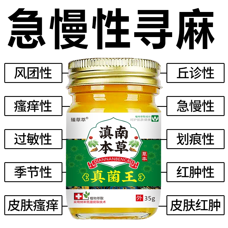 急慢性荨麻诊过敏风团型胆碱性划痕性皮焱湿诊皮肤瘙痒外用止痒膏