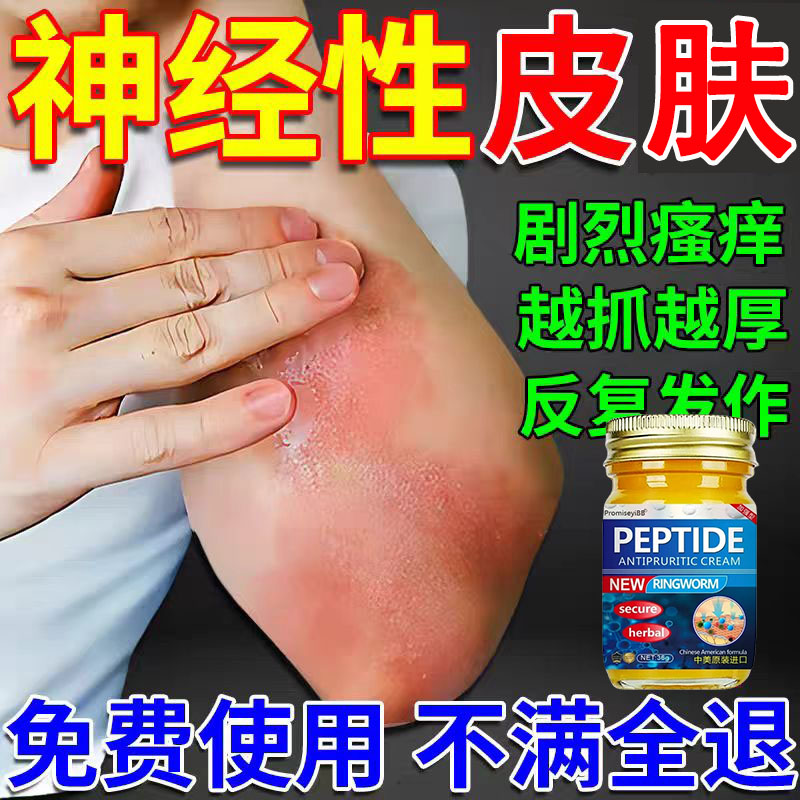 【神经性皮肤】脂溢性皮肤痒日光性皮肤痒全身可用清凉止痒外用乳膏