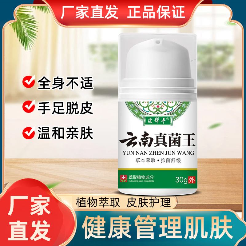 云南真菌王快速止痒皮肤瘙痒全身干痒止痒膏皮肤瘙痒抑菌正品止痒