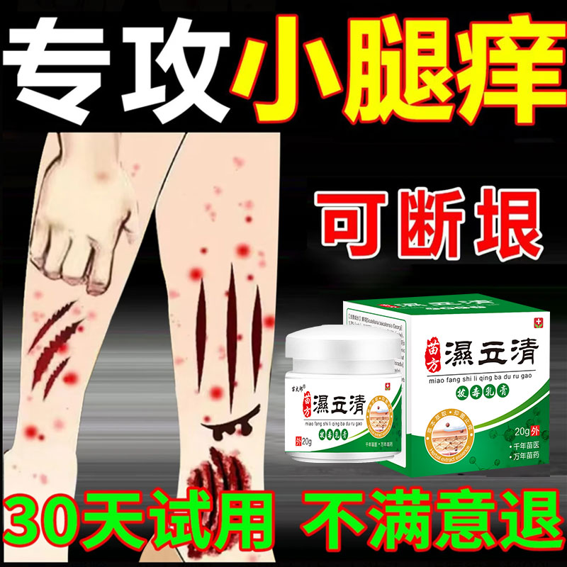 皮肤湿毒痒特效药腿干燥瘙痒湿痒止痒膏春夏越抓越痒出血起红疙瘩