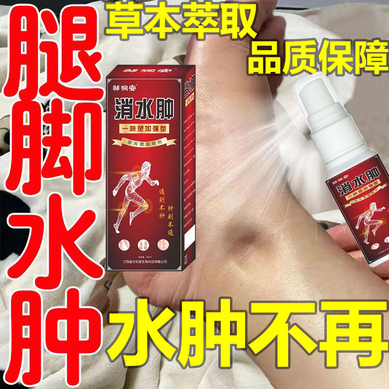 腿脚水肿专用老人下肢水肿脚肿全身水肿穿鞋困难四肢酸麻浮肿喷剂