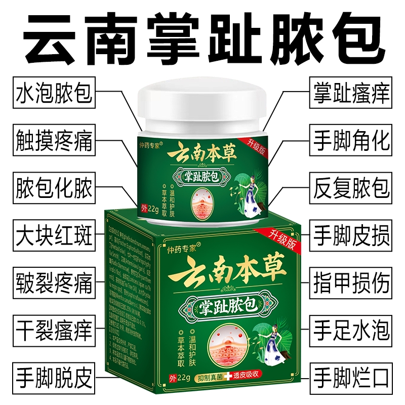 掌跖脓包病膏掌趾脓包手足脓包病脚浓泡脱皮干裂掌跖角化症红斑