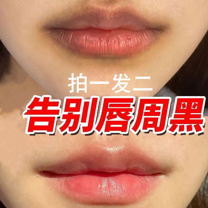 去唇周黑嘴角暗沉黑色素沉淀去除改善产品唇部提亮淡纹润唇V精华