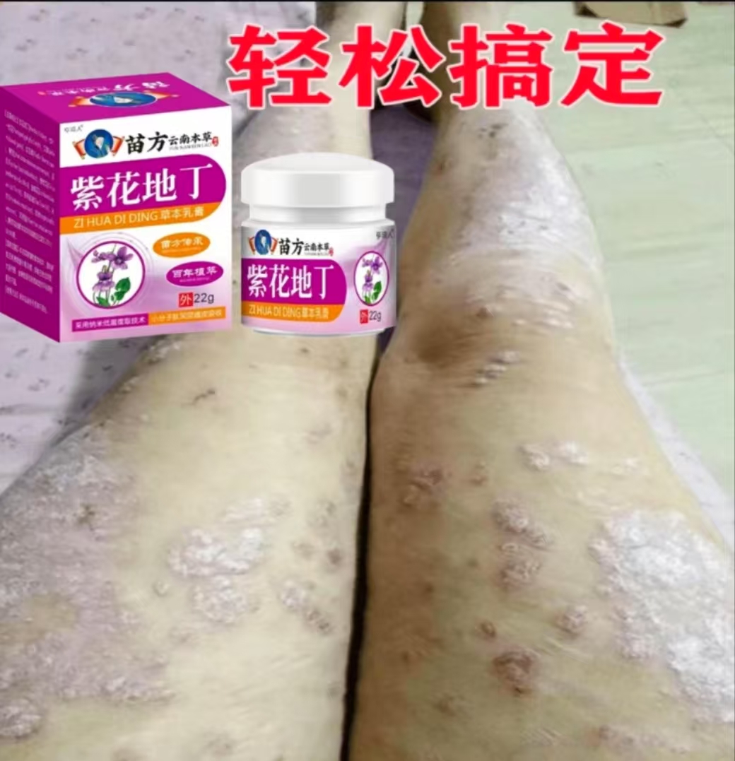 一款很牛的乳膏】全身牛/皮痒草本抑菌膏