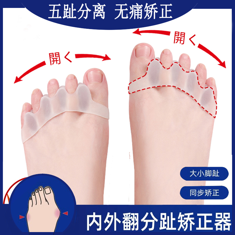 脚趾矫正神器矫正脚趾外翻神器大脚骨突出小脚趾分趾器拇外翻神器