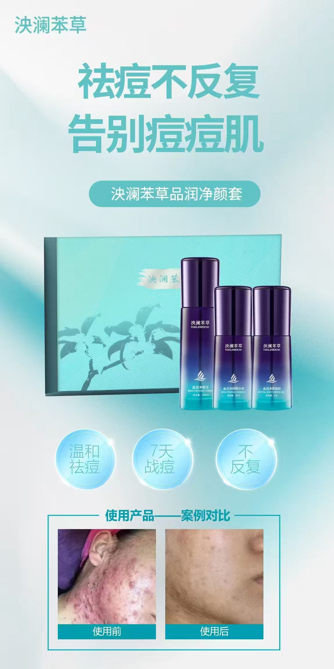 泱澜苯草晶润净颜套盒祛痘保湿爽肤正品保证升级版新包装保湿套装