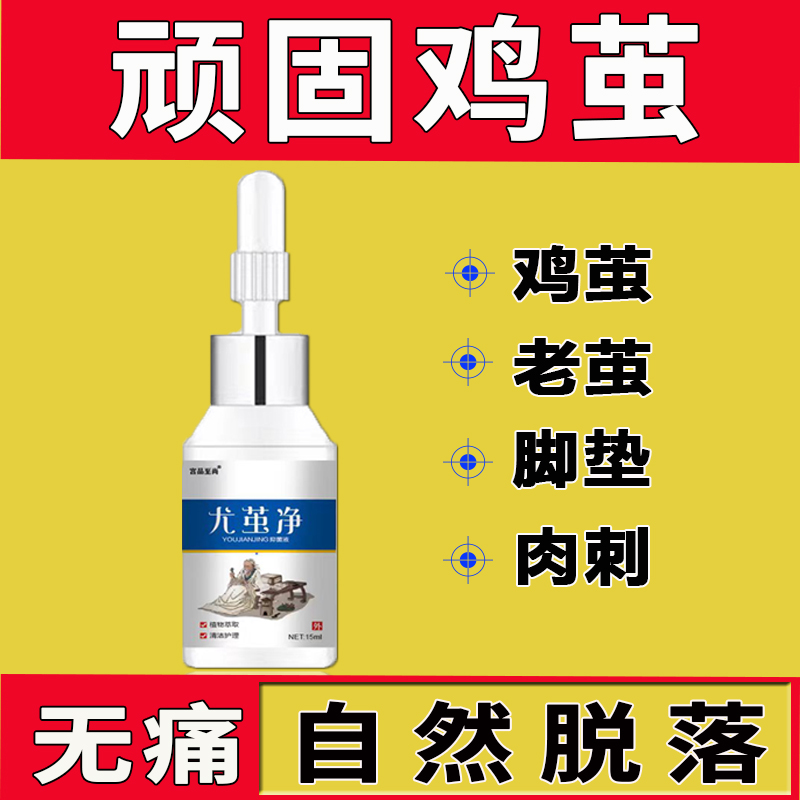 宫品至尚尤茧净去鸡茧老茧膏软化剂肉刺脚钉厚茧草本萃取足部护理