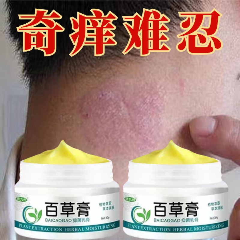 【百草膏】全身牛/皮/银/屑/手足头体股大腿内侧止痒软膏药专用肤癣