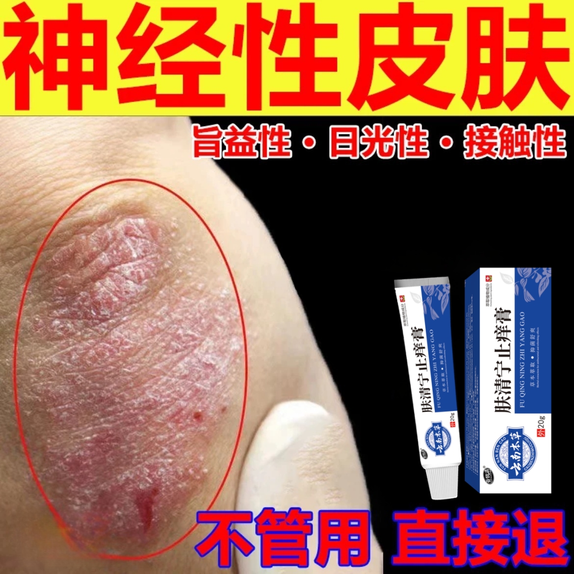 肤清宁瘙痒止痒膏神经性皮肤湿痒手脚水泡小腿全身可用抑菌专用
