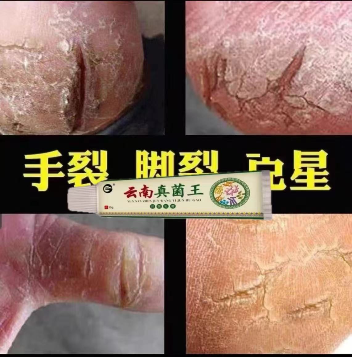 脚裂脱皮膏脚后跟干裂手裂脚裂口手脚开裂修复干裂裂口保湿修护