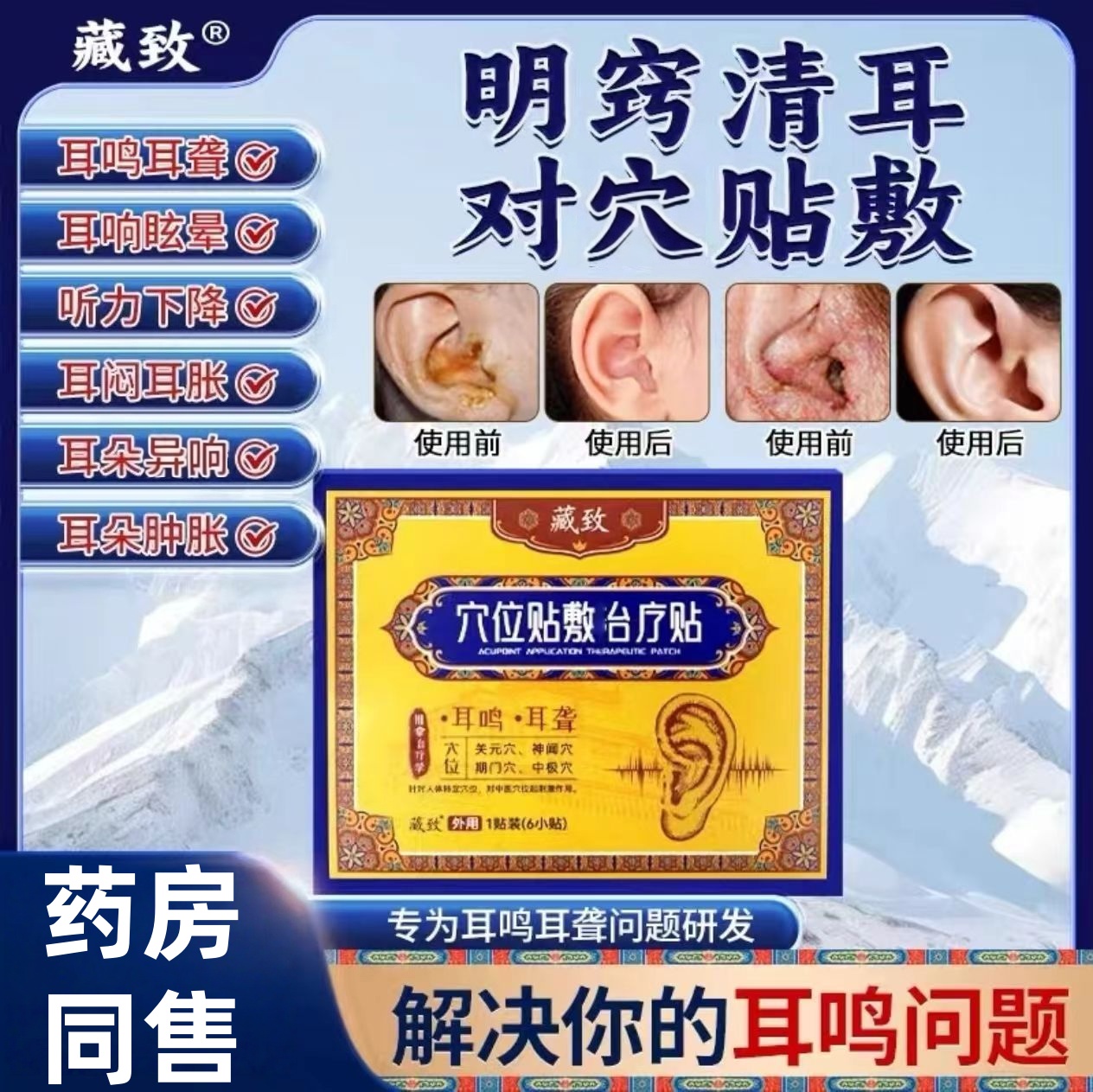 【药房同售】耳聋耳鸣贴耳鸣神经性专用膏贴呵护耳道缓解耳朵嗡嗡响