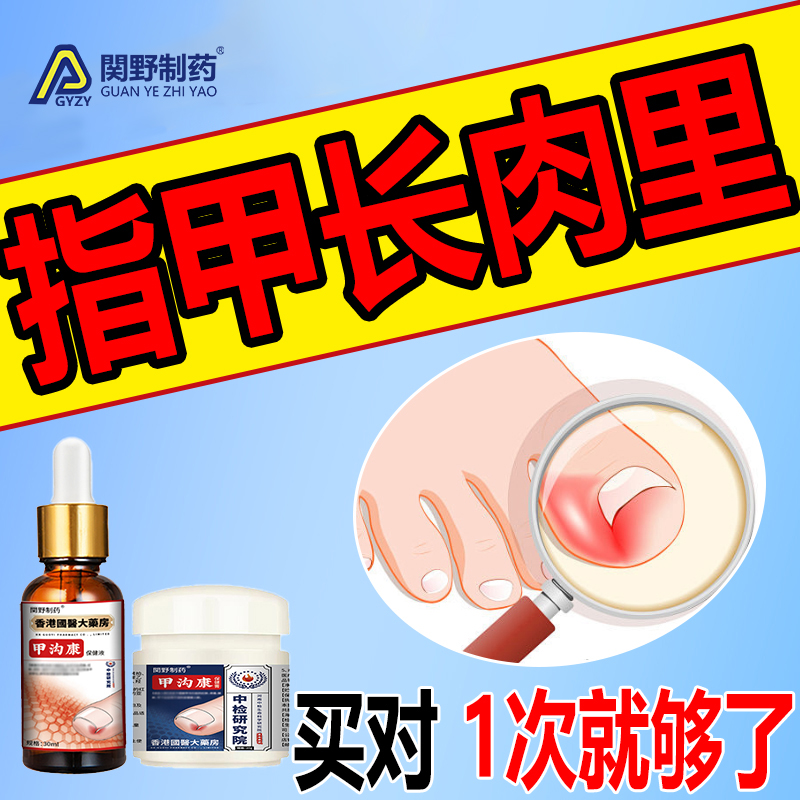 指甲长肉里甲沟软甲脱甲脚趾甲嵌甲肉芽脚指头疼甲沟膏