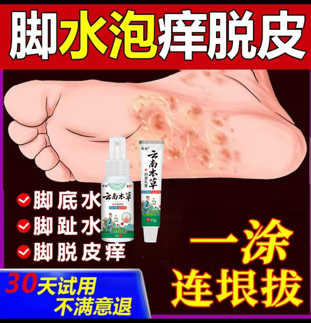 脚底脚上起小水泡又痒又脱皮脚臭气止痒真菌感染抑菌特效克星神器