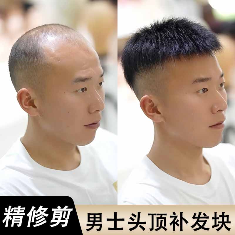 男士假发短发真发帅气隐形头顶补发夏季薄款秃顶遮白发男士补发片