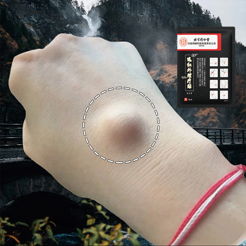 内廷上用腱鞘炎囊肿专用膏药贴大拇指关节痛红肿酸麻僵软弯曲困难关节炎咔咔响远红外理疗贴