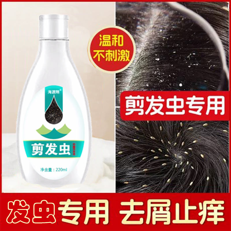 祛剪发虫洗发水露去屑专用除止痒控油大女孩卷发虫头上白点点串虫