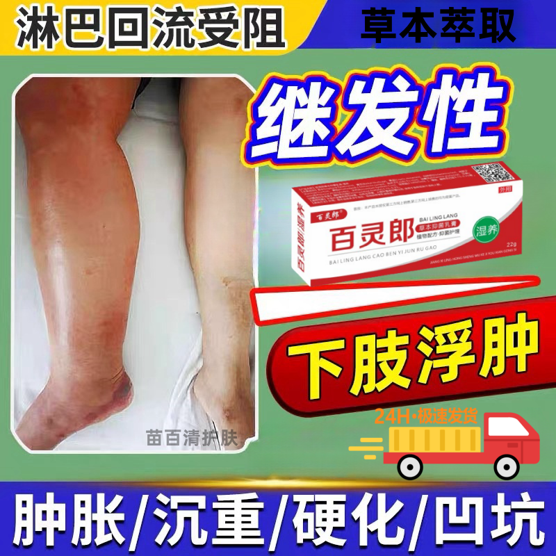 去浮肿脚背浮肿四肢浮肿手脚肿涨腿肿水肿消肿特肿走路困难BL膏