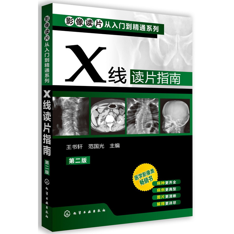 全新正版 X线读片指南 第2版 影像读片从入门到精通系列 临