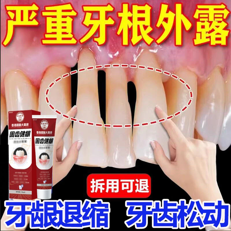 牙龈萎缩专用牙膏正品官方牙齿松动牙膏牙根暴露牙缝宽护龈固齿
