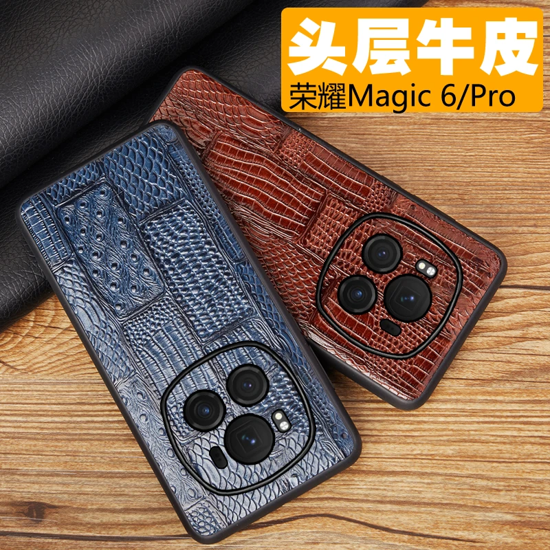荣耀Magic6pro真皮镜头全包手机壳5/4保护壳防摔头层牛皮奢华商务