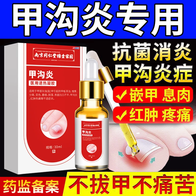 甲沟炎医用退热凝胶指嵌甲修复液息肉消红肿脚趾矫正同仁堂藤阳