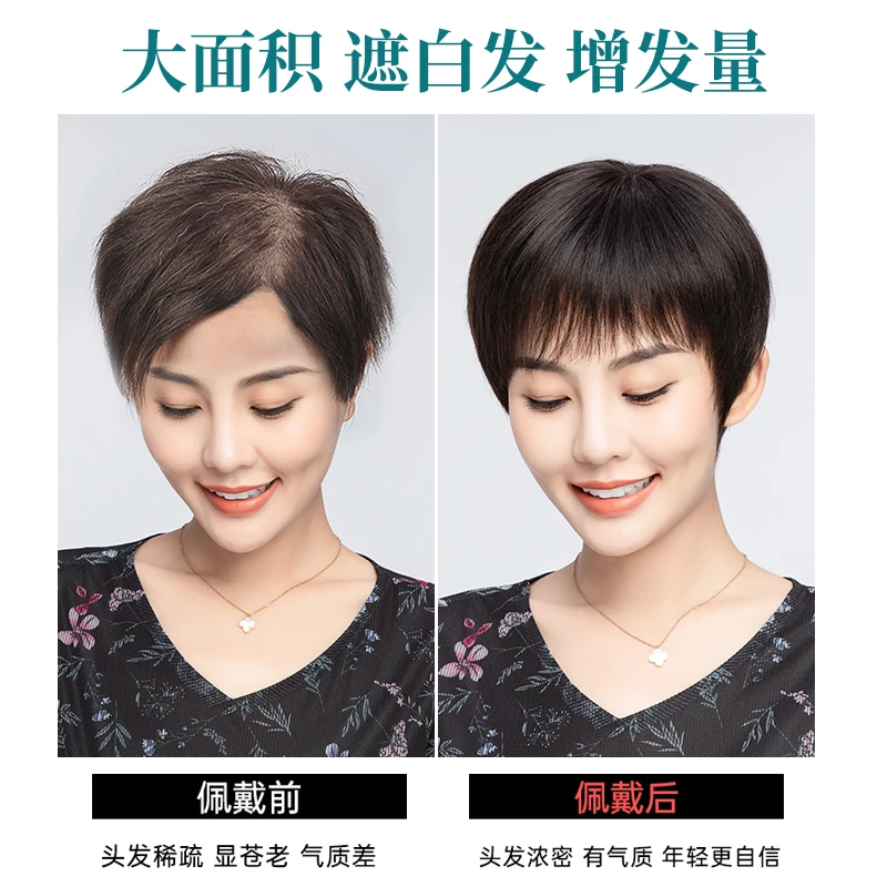 假发片女头顶补发块全真发中老年妈妈遮白发神器盖秃顶夏轻薄短发