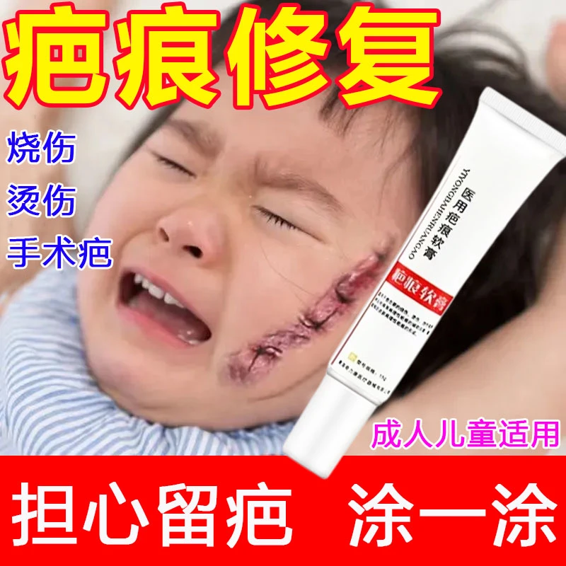 金力康疤痕膏修复疤痕增生凸起烧烫伤创伤手术剖腹产疤医用疤痕软膏15g