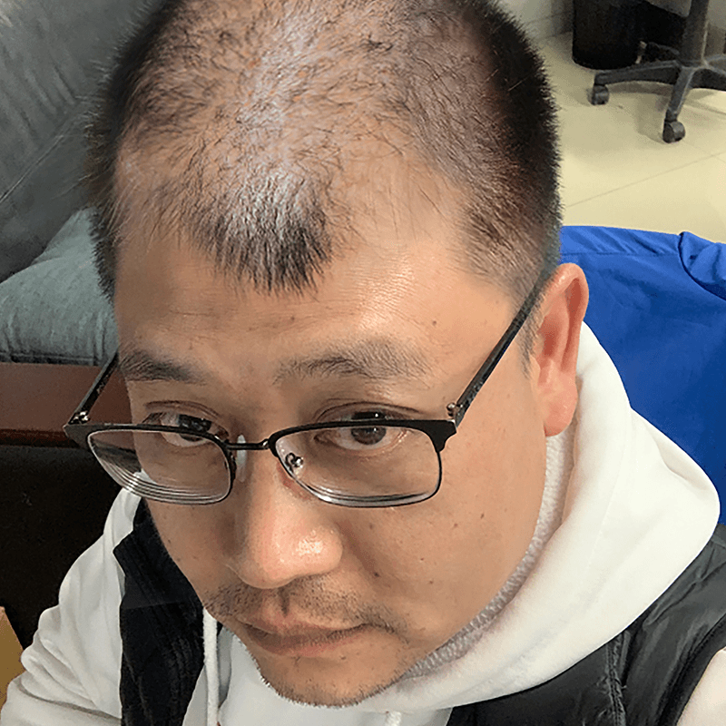 育发精华 主播以前照片对比