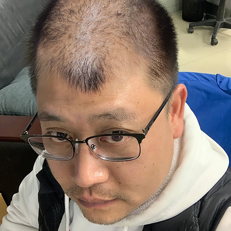 育发精华 主播以前照片对比
