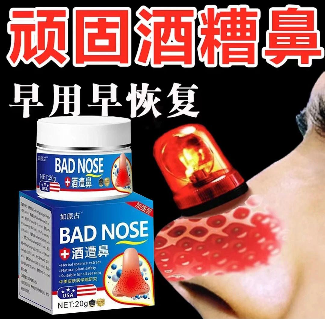 鼻翼两侧发红脱皮脱屑痒皮肤干燥起皮专用乳膏