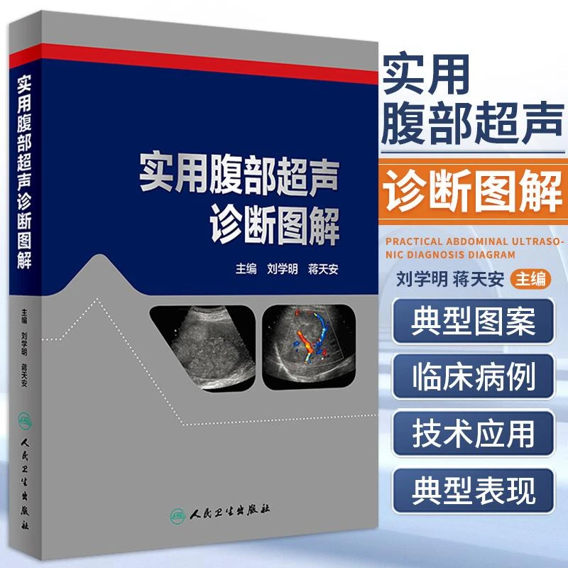 实用腹部超声诊断图解 影像医学参考书籍 医学参考书籍 2019年7月