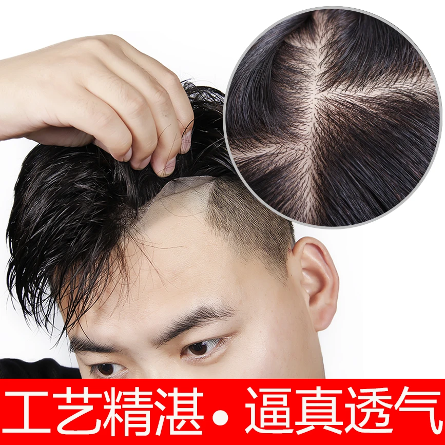 （递针款）男士假发补发片发块真发男假发手织秃顶送胶片梳子护理液