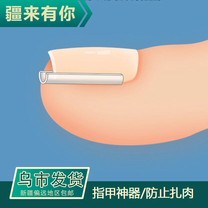 【疆来有你-乌市发货】指甲神器大脚趾甲往肉里长便携指甲垫片
