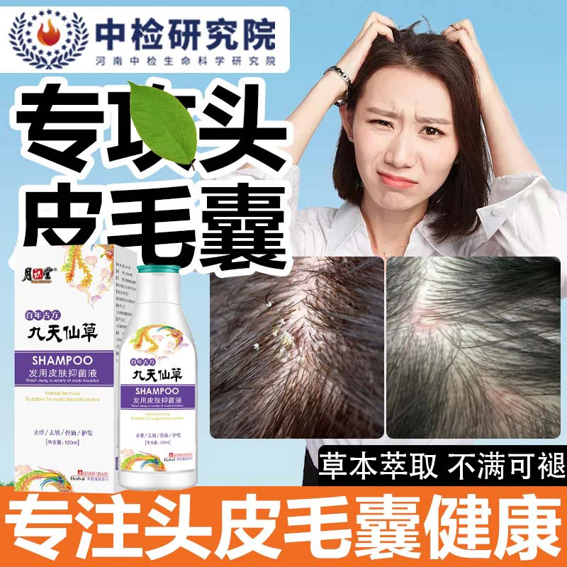 毛炎宁毛囊除螨洗发水头部家用去屑止痒抑菌头皮长红疙瘩痘痘