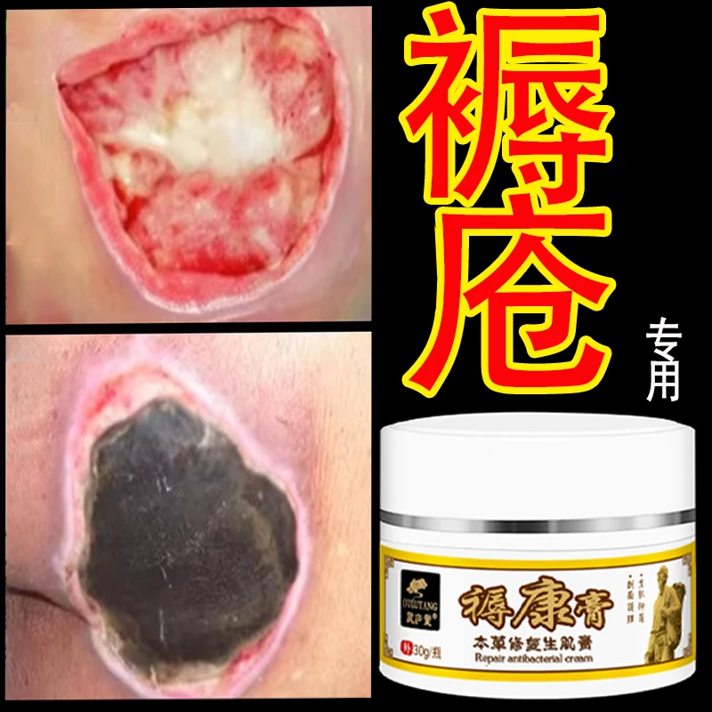 褥创瘡生肌膏臀部腐烂草本软膏