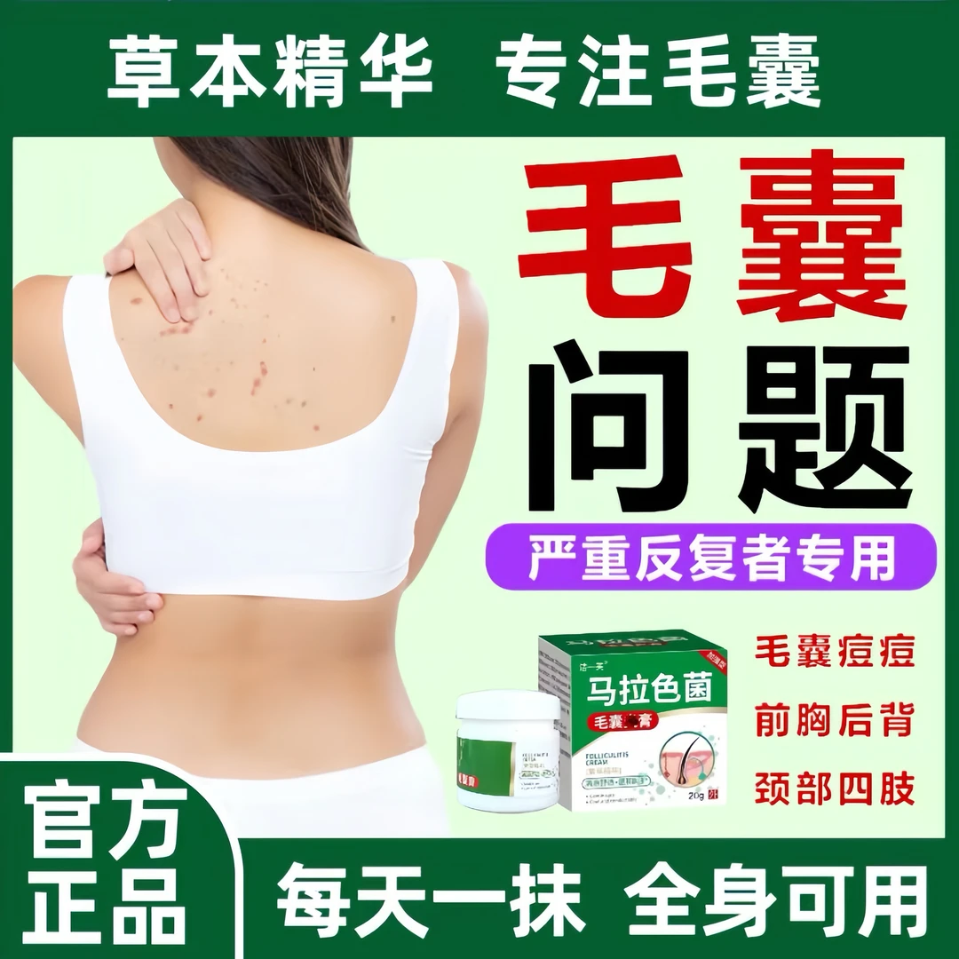 【官方正品】马拉色菌抑菌乳膏头皮毛囊前胸后背红点小疙瘩草本抑菌