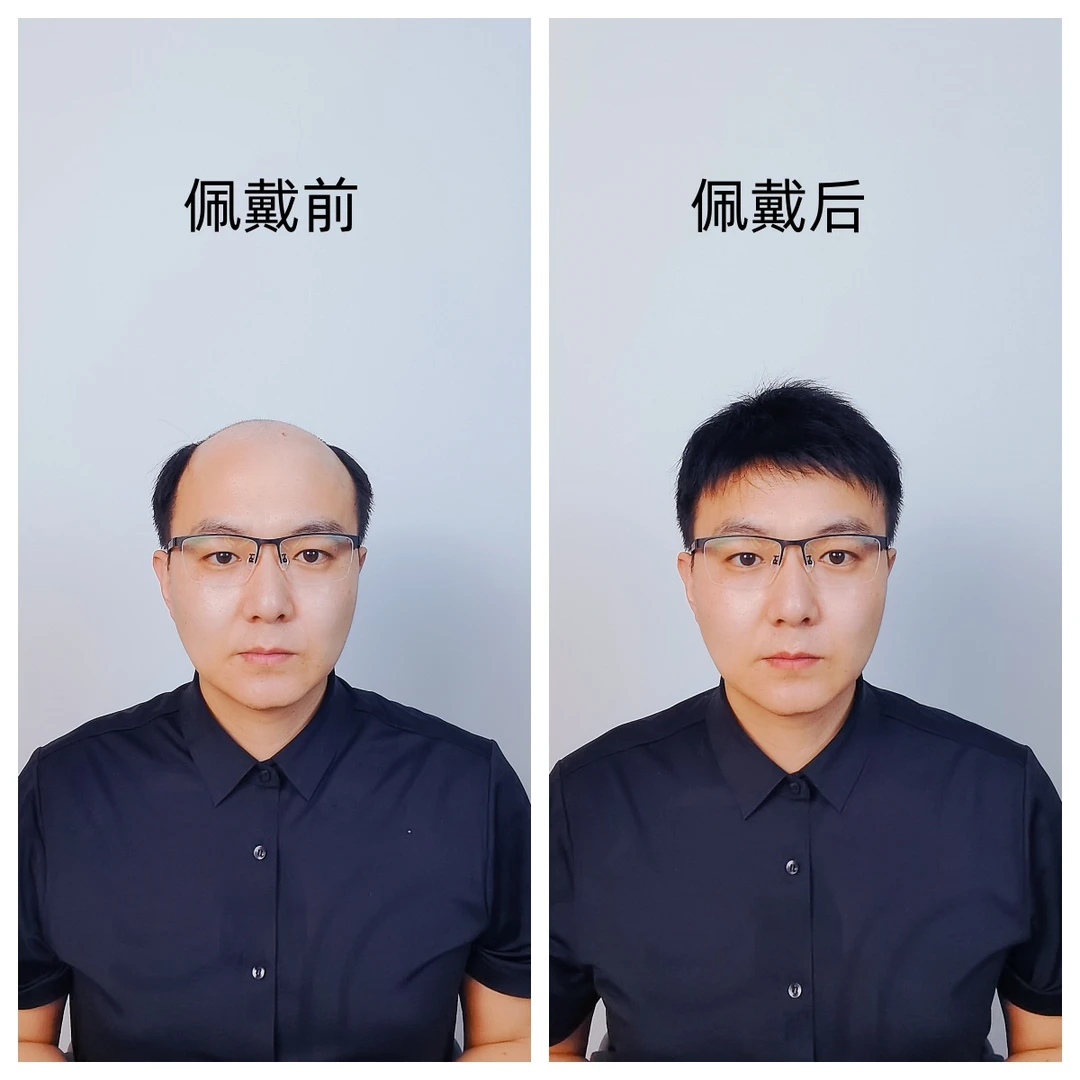 【全手织 全真发】男士假发头顶脱发补发片 进口网轻薄透气隐形仿真