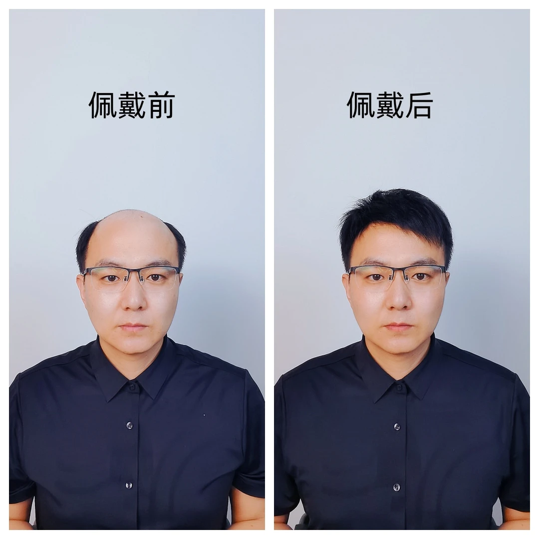【D针头旋 全真发】男士假发补发片高端纯手工隐形轻薄透气假发定制