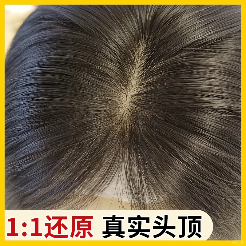 双递针假发片真发女头顶遮白发增发量高颅顶神器无痕补发片仿肤网