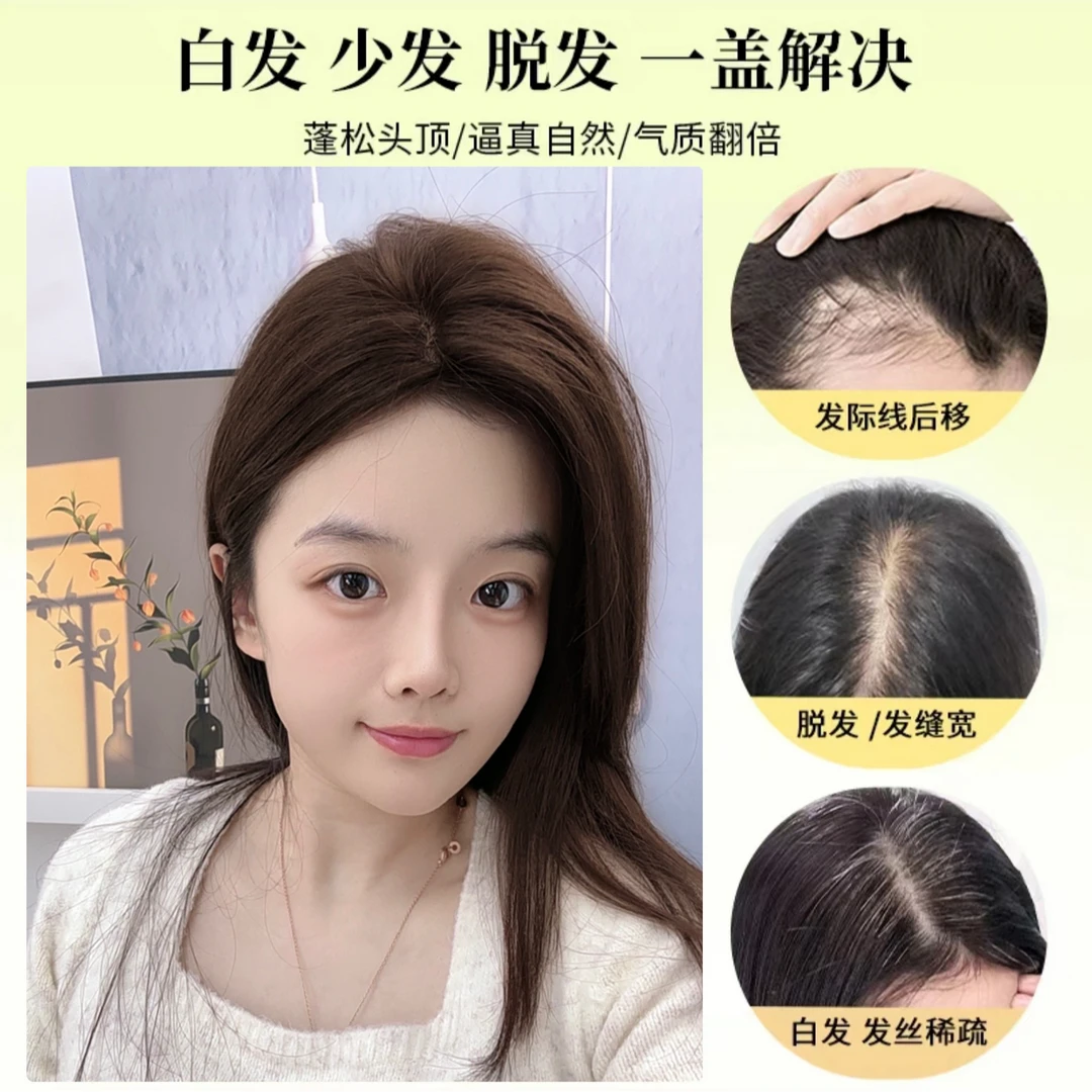 AHVAST假发片女增发量头顶遮白发金丝波点八字刘海真发假发隐形
