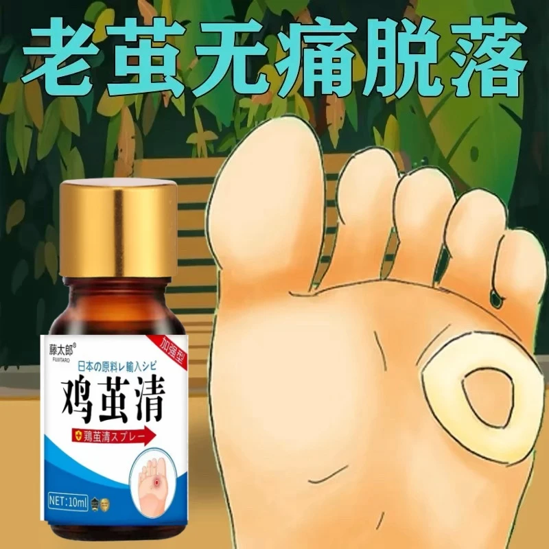 尤茧霸官方正品去鸡茧老茧厚茧脚底脚垫手茧死皮厚茧草本温和护理